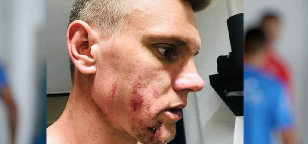 Goleiro Douglas fica em observação após sofrer um corte no rosto